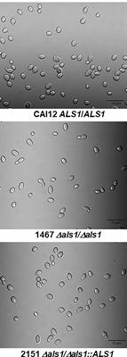 ALS1 Deletion Increases the Proportion of Small Cells in a Candida albicans Culture Population: Hypothesizing a Novel Role for Als1